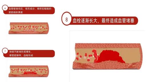 改善血瘀---现代“熥疗”+中药提取物复配精油 文章引述：植物提取物专家、中药科学家 陈冲