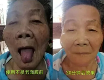 王军安：中医界的传奇开拓者，揭秘瘫痪之谜
