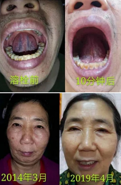 王军安：中医界的传奇开拓者，揭秘瘫痪之谜