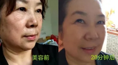 王军安：中医界的传奇开拓者，揭秘瘫痪之谜