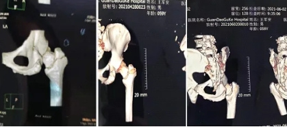 王军安：中医界的传奇开拓者，揭秘瘫痪之谜