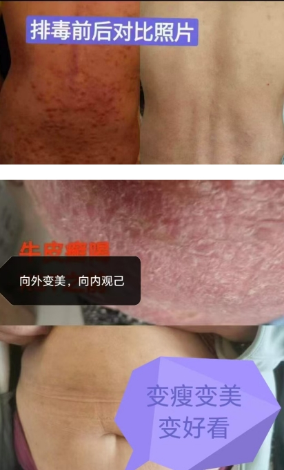 赵家为：针灸妙手，仁心济世，点亮中医之光