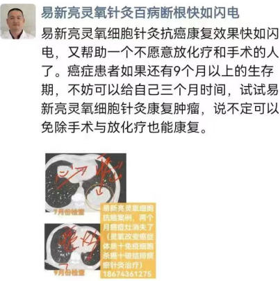 易新亮 开启新冠后遗症、三高糖尿病、风湿免疫病、肿瘤的康复新纪元