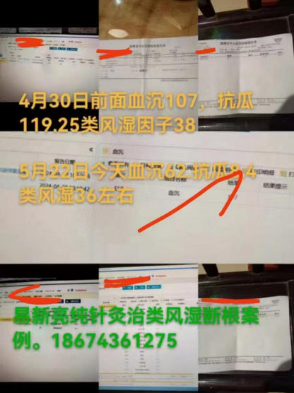 易新亮 开启新冠后遗症、三高糖尿病、风湿免疫病、肿瘤的康复新纪元