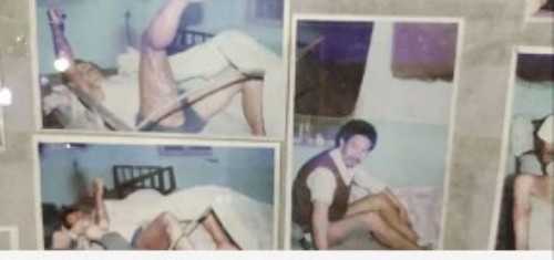 以身试药的中医传奇：刘中胜与他的烧伤康复“神膏”