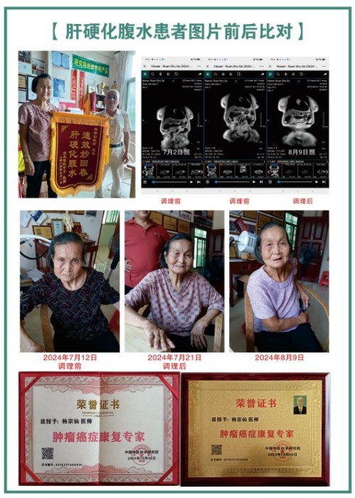 礼赞八一专题报道 著名国医大师---杨宗仙