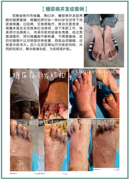 礼赞八一专题报道 著名国医大师---杨宗仙