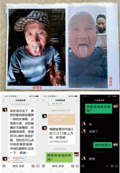 礼赞八一专题报道 著名国医大师---杨宗仙