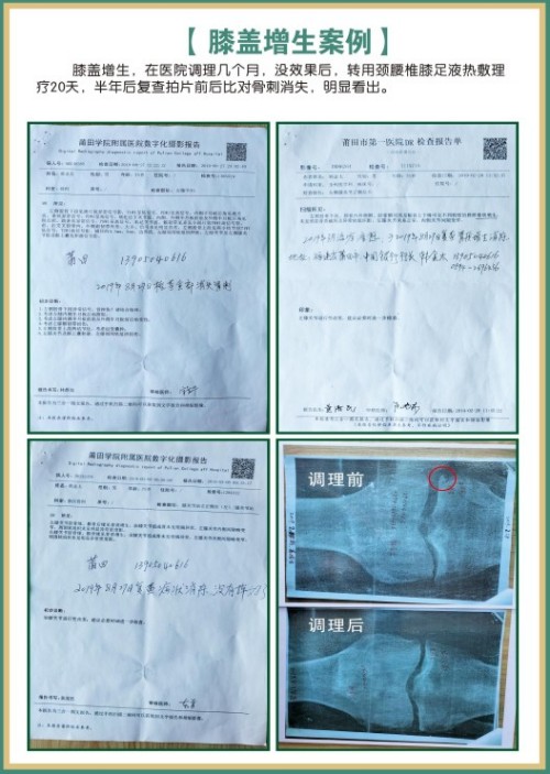 礼赞八一专题报道 著名国医大师---杨宗仙