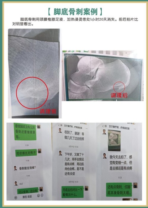 礼赞八一专题报道 著名国医大师---杨宗仙