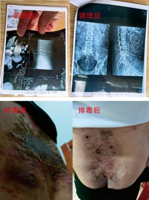 礼赞八一专题报道 著名国医大师---杨宗仙