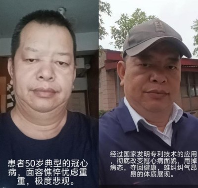 冠心病！世界医学研究难以治愈。中国发明！痊愈冠心病突破难关！