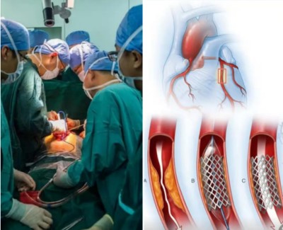 冠心病！世界医学研究难以治愈。中国发明！痊愈冠心病突破难关！