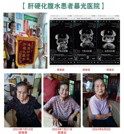 关爱生命：杨宗仙与仙防癌抗癌灭癌中医实践