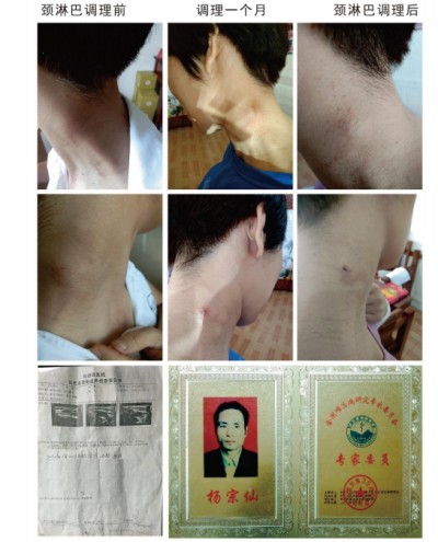 关爱生命：杨宗仙与仙防癌抗癌灭癌中医实践