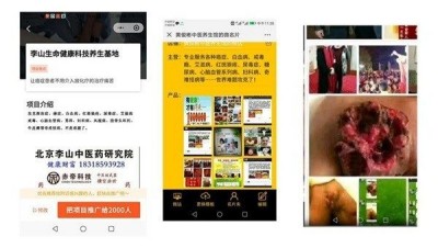 国医大师——黄俊彬